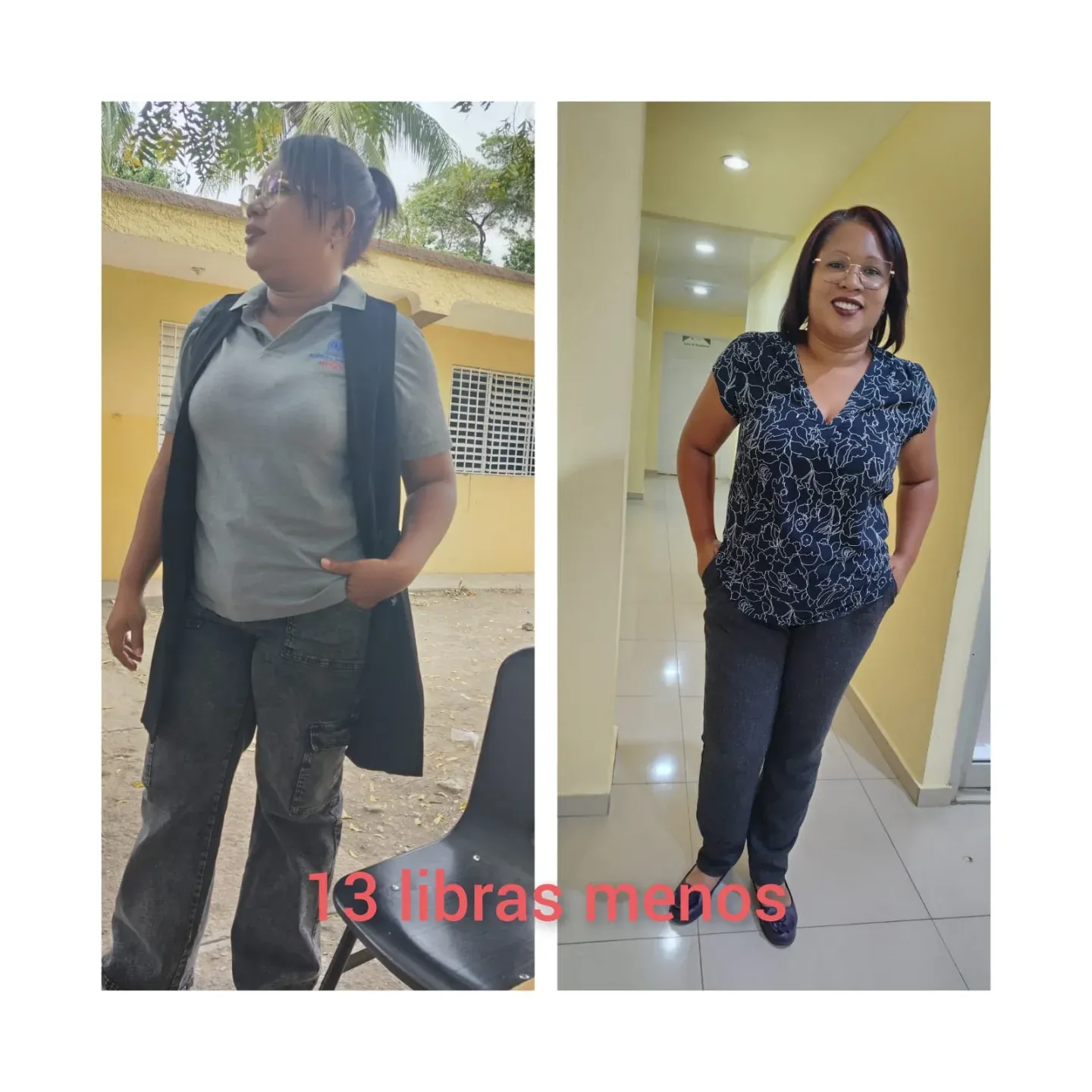 Transformación paciente bariátrico exitosa