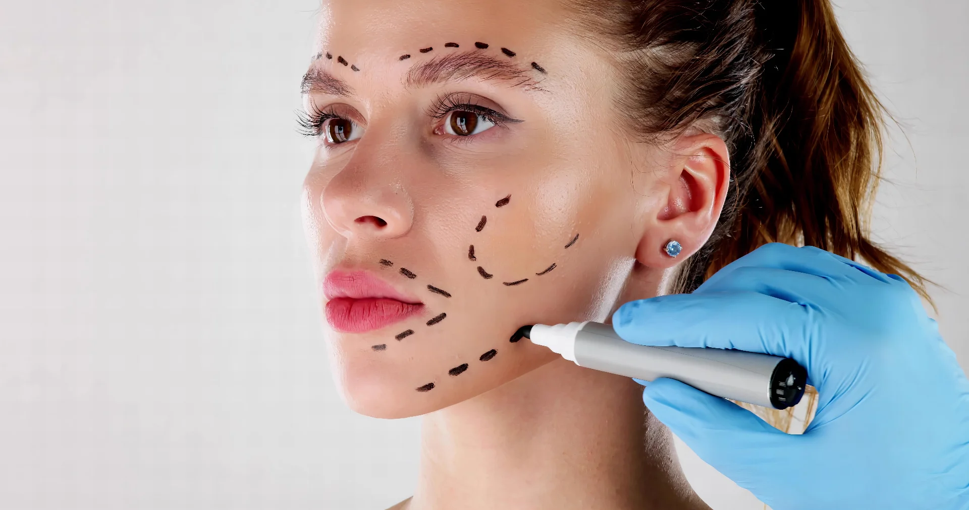 Cirugía Facial